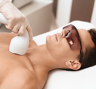 Laser Hair Removal